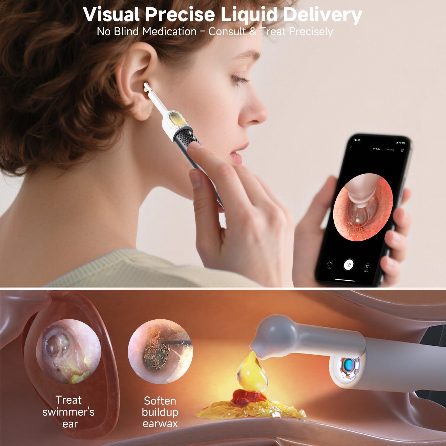 Bebird Ear Wax Removal Tools, Bebird Ear Cleaner, 1080P HD Endoscope, Wireless Earwax Removal Tools with 6 LED Lights, Compatible with iPhone & Android and Kids, Adults (Black) 🍁 All In One Marketplace Canada