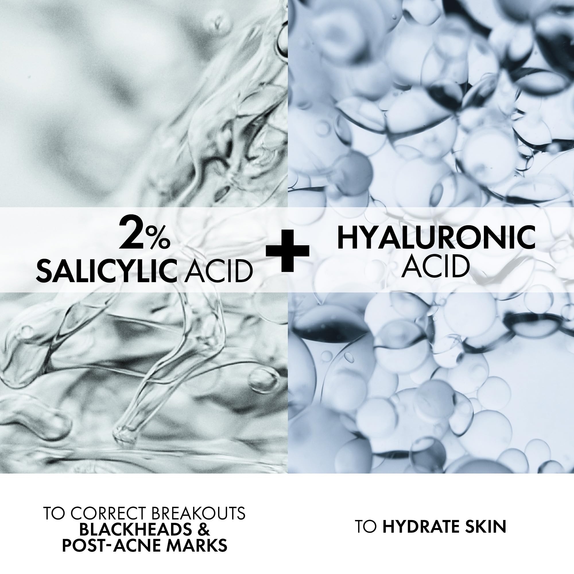 Vichy Face Cream for Acne-Prone Skin, Normaderm Double-Action Anti-Acne Face Moisturizer with Salicylic Acid, Oil-Free, Non-Comedogenic, Hypoallergenic, & Paraben-Free, 50mL 🍁 All In One Marketplace Canada