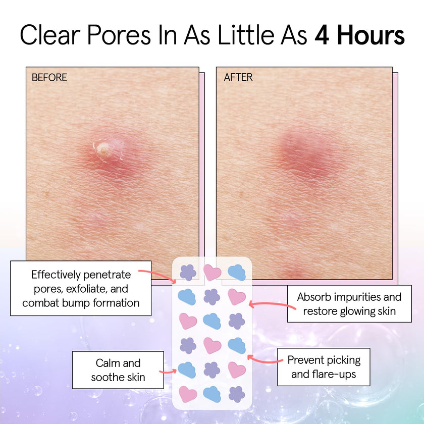 grace & stella Award Winning Hydrocolloid Patches with Salicylic Acid (Multishape, 36 Count) - Covers with Tea Tree - Patches for Impurities - Dermatologist Tested Skin Care, Cruelty Free, Vegan 🍁 All In One Marketplace Canada