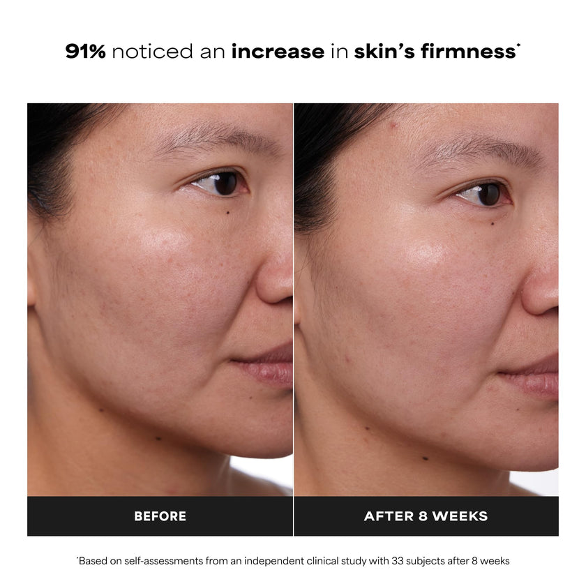 Paula's Choice CLINICAL 1% Retinol Treatment Cream with Peptides, Vitamin C & Licorice Extract, Anti-Aging Treatment for Wrinkles & Loss of Firmness, Fragrance-Free, 30 mL 🍁 All In One Marketplace Canada