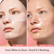 Rael Collagen PDRN Hydrogel Mask - Deep Hydration, Daily Face Masks for Face, Korean Skincare (4 Count) 🍁 All In One Marketplace Canada