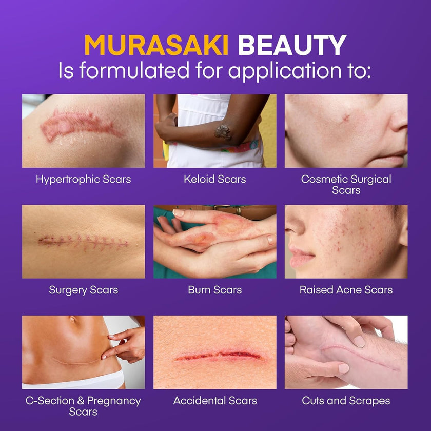 Silicone Scar Gel Scar Cream - SPF 30 Advanced Scar Gel for Old and New Scars 🍁 All In One Marketplace Canada