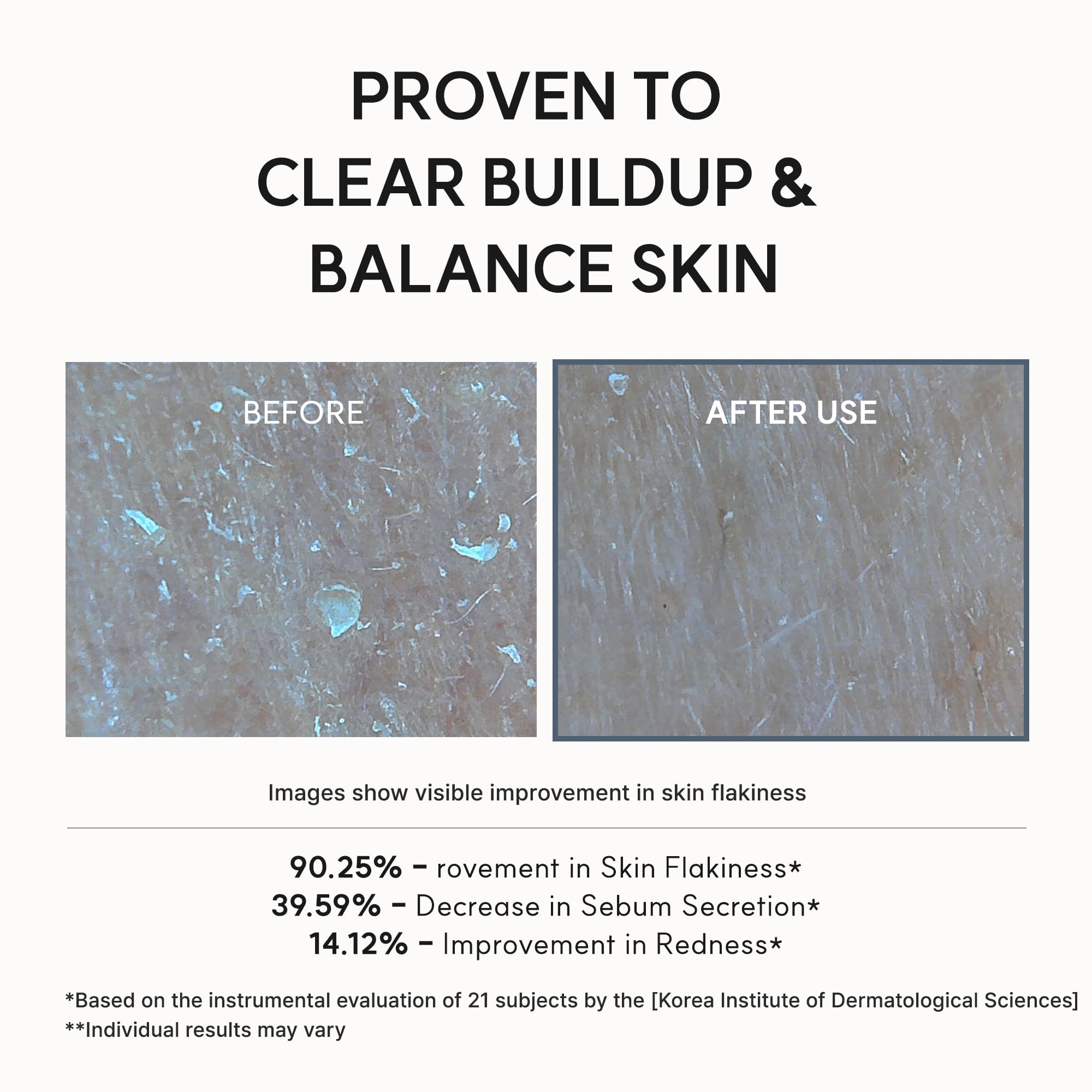 Arencia Eraser Serum Glycolic Acid Booster with AHA BHA, Exfoliating Face Serum for Acne-Prone Skin, Pore Care & Texture Refining, Lightweight Daily Skincare, 30 mL 🍁 All In One Marketplace Canada