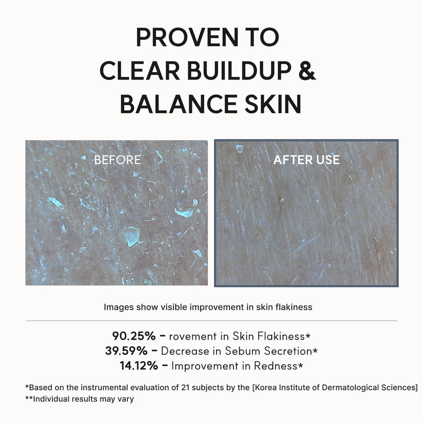 Arencia Eraser Serum Glycolic Acid Booster with AHA BHA, Exfoliating Face Serum for Acne-Prone Skin, Pore Care & Texture Refining, Lightweight Daily Skincare, 30 mL 🍁 All In One Marketplace Canada
