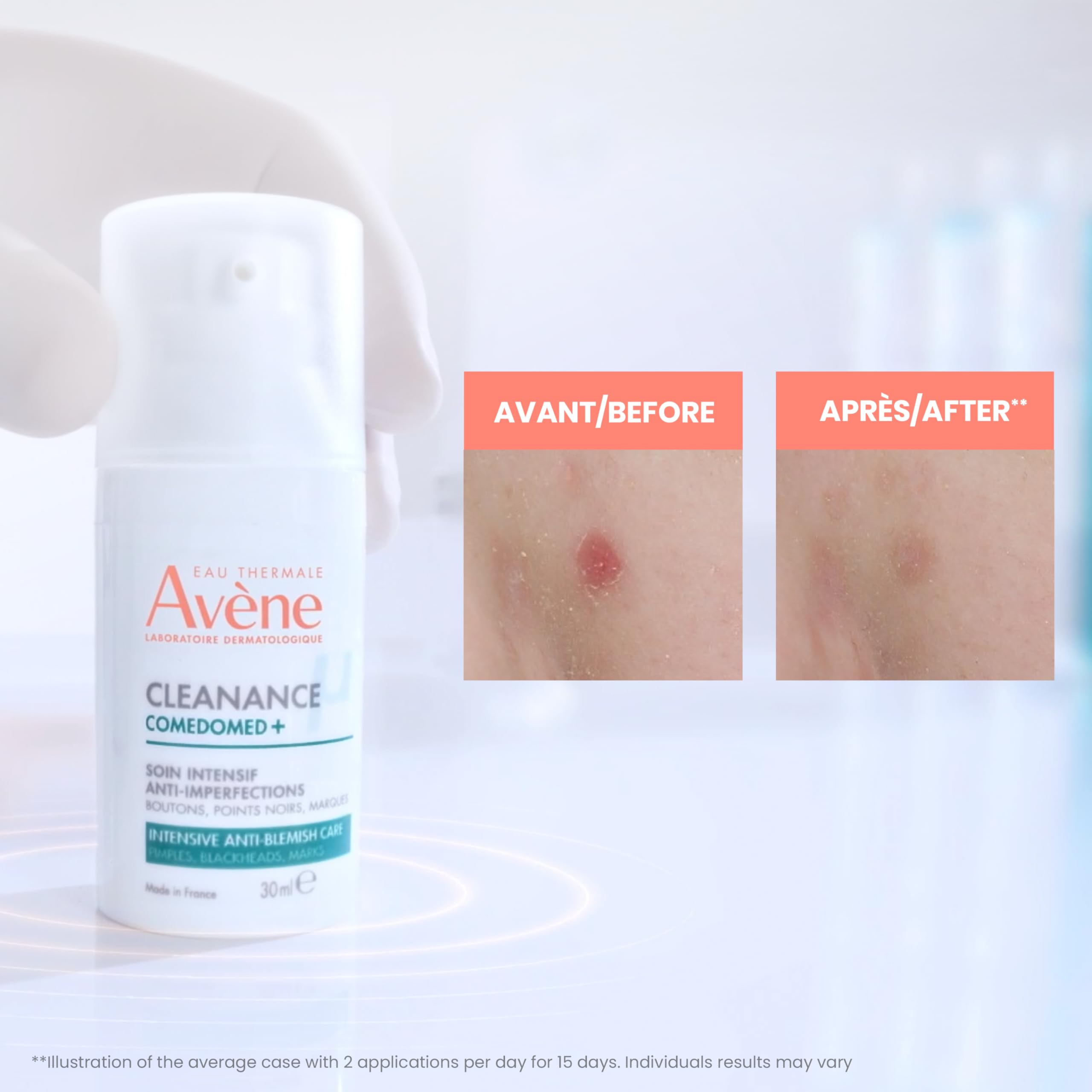 Eau Thermale Avene Cleanance Comedomed+ anti-blemish cream, niacinamide, 30 ml 🍁 All In One Marketplace Canada