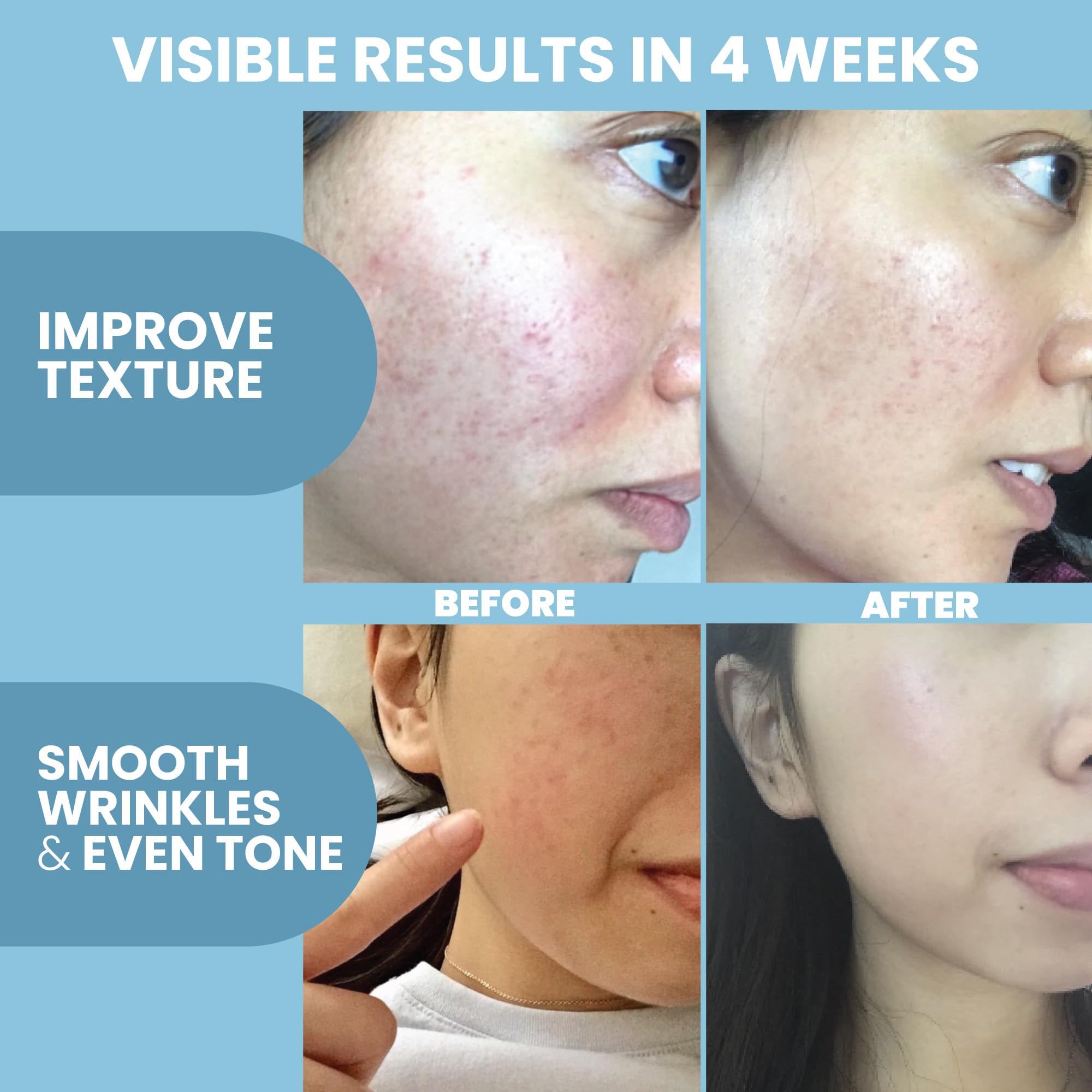 Eva Naturals Peptide Serum for Face – Collagen Boosting Anti-Aging Facial Serum for Wrinkles, Fine Lines & Microneedling – Skin Firming, Smoothing & Hydrating Peptides Booster 🍁 All In One Marketplace Canada
