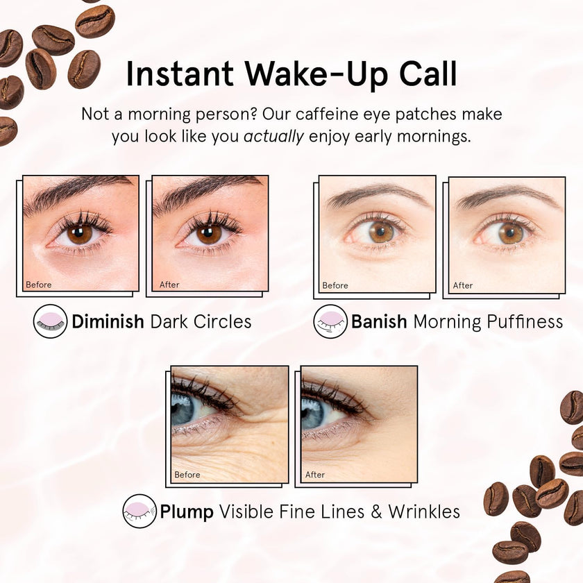 grace and stella Eye Patches with Caffeine - Under Eye Patches for Puffy Eyes - Revitalizing Under Eye Mask - Eye Pads with Niacinamide & Hyaluronic Acid - Vegan Eye Mask Skincare, 24 Pairs 🍁 All In One Marketplace Canada