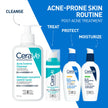 CeraVe Resurfacing Retinol Serum For Face with Niacinamide. Helps even Skin Tone & Smoothness, Post-Acne Marks & Pore Minimizer. Gentle, Fragrance-free, Non-Comedogenic, Safe for Sensitive Skin, 30ML 🍁 All In One Marketplace Canada