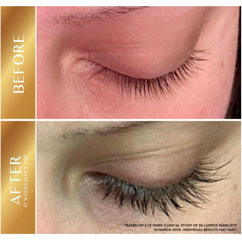 LUXROS Eyelash Serum 5 mL, Eyelash Enhancer Serum for Longer, Thicker Healthier Lashes, Made in USA, 5mL 6 Month Supply 🍁 All In One Marketplace Canada
