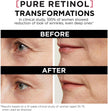 L'Oreal Paris 0.3% Pure Retinol Serum for Face, Night Serum Visibly Reduces the Look of Deep Wrinkles & Smoothes Texture, Revitalift Derm Intensives, 30ml 🍁 All In One Marketplace Canada
