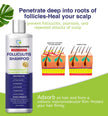 Folliculitis & Seborrheic Dermatitis Shampoo – Anti-Dandruff Scalp Care for Itchy, Flaky, Dry Scalp, Helps Relieve Irritation & Discomfort 🍁 All In One Marketplace Canada