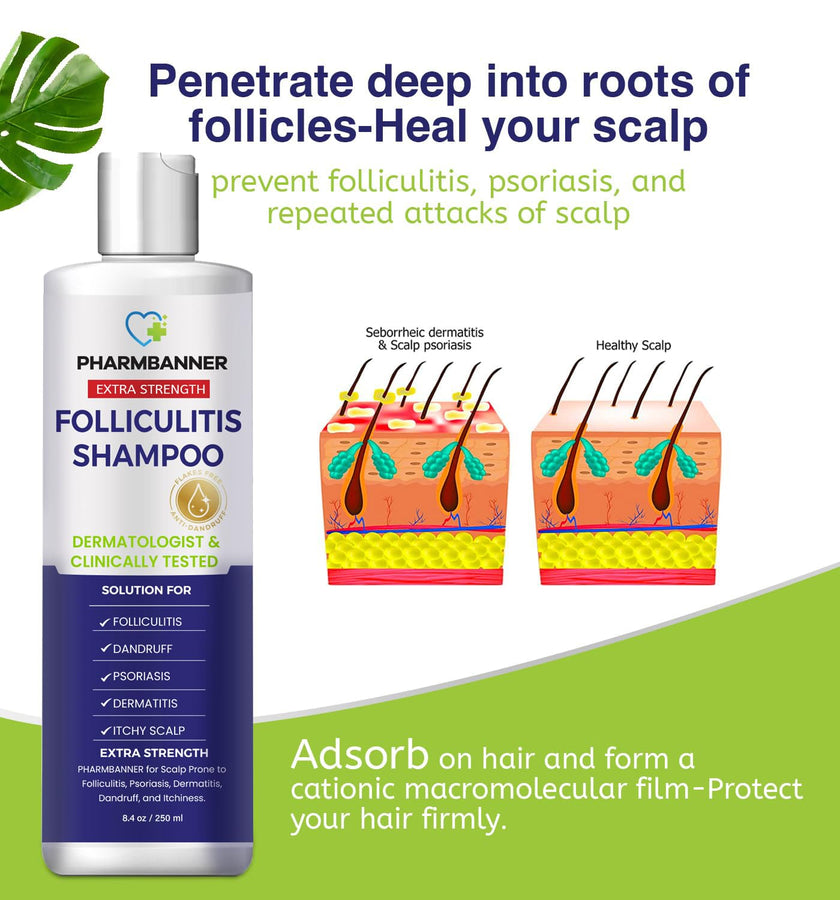 Folliculitis & Seborrheic Dermatitis Shampoo – Anti-Dandruff Scalp Care for Itchy, Flaky, Dry Scalp, Helps Relieve Irritation & Discomfort 🍁 All In One Marketplace Canada