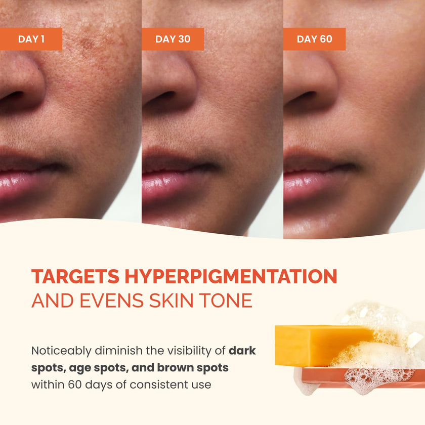 PLANTIFIQUE Turmeric & Kojic Acid Soap for Hyperpigmentation, Lab Tested - 4 Bars with Mesh Net - Face & Body Wash with Hyaluronic Acid, Collagen, Vitamin C - 320g / 11.28 oz 🍁 All In One Marketplace Canada