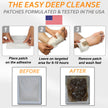 Dr. Entre's Foot Patch: Deep Cleansing Foot Pads | Effective Premium Turmeric & Ginger Foot Patches | 20 Pack 🍁 All In One Marketplace Canada