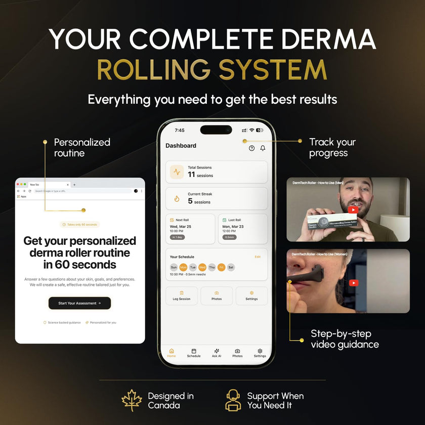 Derma Microneedling Roller - 1.5mm Titanium Needles - Designed in Canada - for Men and Women - Storage Case Included (Matte Black) 🍁 All In One Marketplace Canada