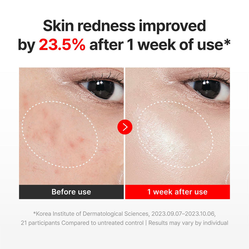 CENTELLIAN 24 Madeca Cream Time Reverse (1.69fl oz) - Advanced Fast-Absorbing & Nourishing, Hydrates, Firms & Reduces Wrinkles, Low Irritation, Korean Skin Care Centella Asiatica, Collagen 🍁 All In One Marketplace Canada