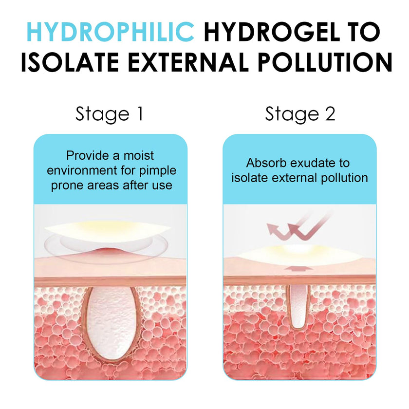 320 PCS Pimple Patch Star Invisible Ultra Thin Star-shaped Pimple Patches Colorful Hydrocolloid Patch Skin Care for Face 🍁 All In One Marketplace Canada