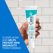 CeraVe Acne Control Gel For Face, Pimple & Pores, With Salicylic Acid, 3 Essential Ceramides, Niacinamides. Developed with Dermatologists, Non-Comedogenic, Oil-Free, Fragrance-Free, 40ml 🍁 All In One Marketplace Canada