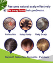 Folliculitis & Seborrheic Dermatitis Shampoo – Anti-Dandruff Scalp Care for Itchy, Flaky, Dry Scalp, Helps Relieve Irritation & Discomfort 🍁 All In One Marketplace Canada