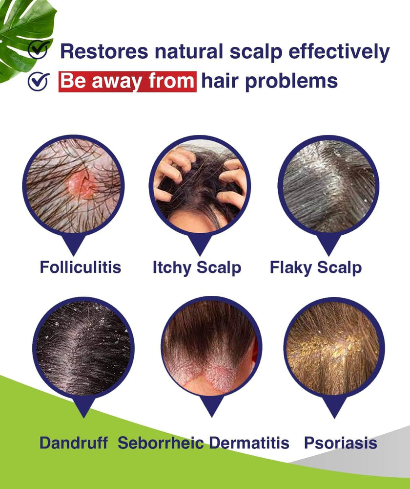 Folliculitis & Seborrheic Dermatitis Shampoo – Anti-Dandruff Scalp Care for Itchy, Flaky, Dry Scalp, Helps Relieve Irritation & Discomfort 🍁 All In One Marketplace Canada