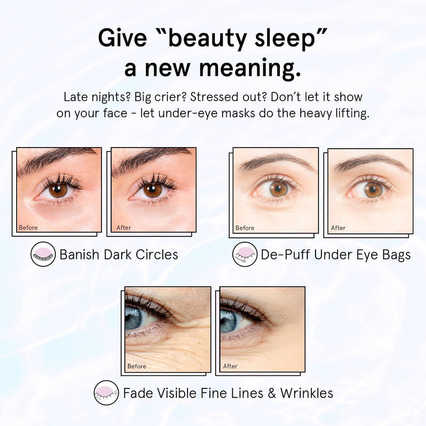 grace & stella Under Eye Masks With Retinol - Revitalizing Under Eye Patches for The Wrinkles & Dark Circles - Gel Eye Mask - Gifts for Mom, Teen Girl Gifts - Vegan, Cruelty-Free (24 Pairs) 🍁 All In One Marketplace Canada