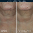 RoC Derm Correxion® Neck Cream with Hyaluronic Acid and Advanced Retinol to visibly Tighten & Lift Horizontal Neck Lines, Facial Moisturiser to Contour Face, Neck and Jawline, 50ML 🍁 All In One Marketplace Canada