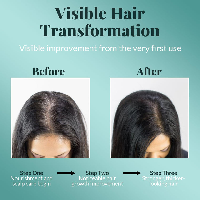AVD Organics Rosemary Oil for Hair Growth | Infused with Biotin | Hair Strengthening, Nourishing and Volumizing | infused with Jojoba & Castor Oil | NON - GMO 120ml 🍁 All In One Marketplace Canada
