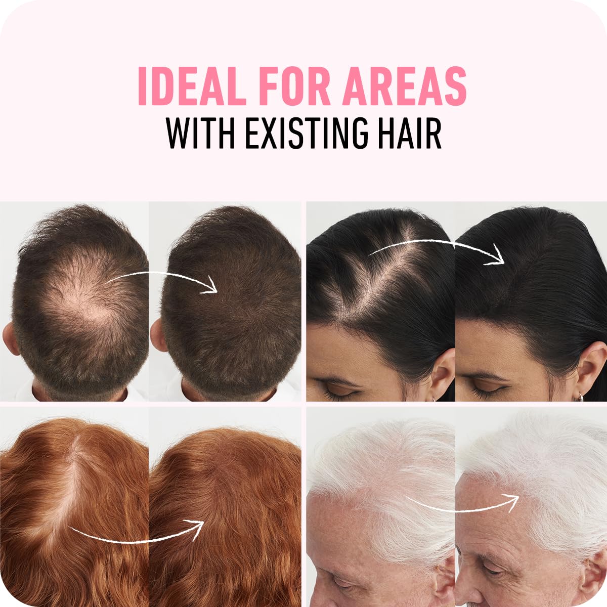 BOLDIFY Hair Fibers (28g) - Fill In Thinning and Fine Hair for an Instantly Fuller, Thicker Look - 14 Shades for Women & Men - Black 🍁 All In One Marketplace Canada