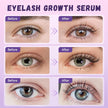 Lash Serum for Growth, Premium Eyelash Enhancer Care for Longer Thicker & Fuller, Gentle Formula Safe for Sensitive Eyes Non-Irritating Daily Use at Home & Travel - 5ml 🍁 All In One Marketplace Canada