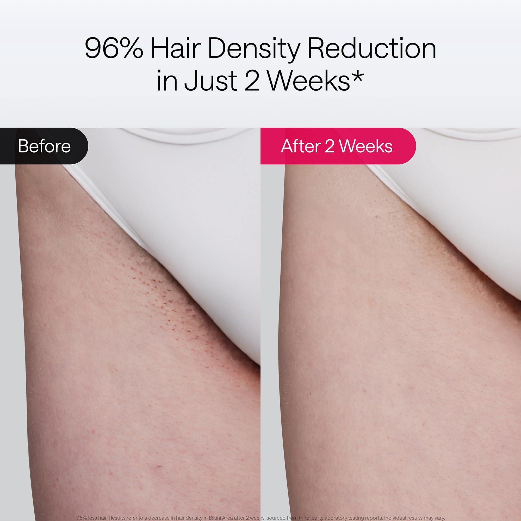 Ulike Laser Hair Removal, Air 10 IPL Device for Women and Men, 65°F Ice-Cooling Contact, Dual Lights, Skin Sensor & SHR Mode* for Nearly Painless, Effective & Long-Lasting Results from Home 🍁 All In One Marketplace Canada