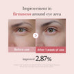 medicube Salmon DNA PDRN Pink Peptide Eye Serum with Niacinamide and 99% Purity Retinol for Fine Lines, Uneven Skin Tone, Korean Skin Care 1.01fl.oz 🍁 All In One Marketplace Canada