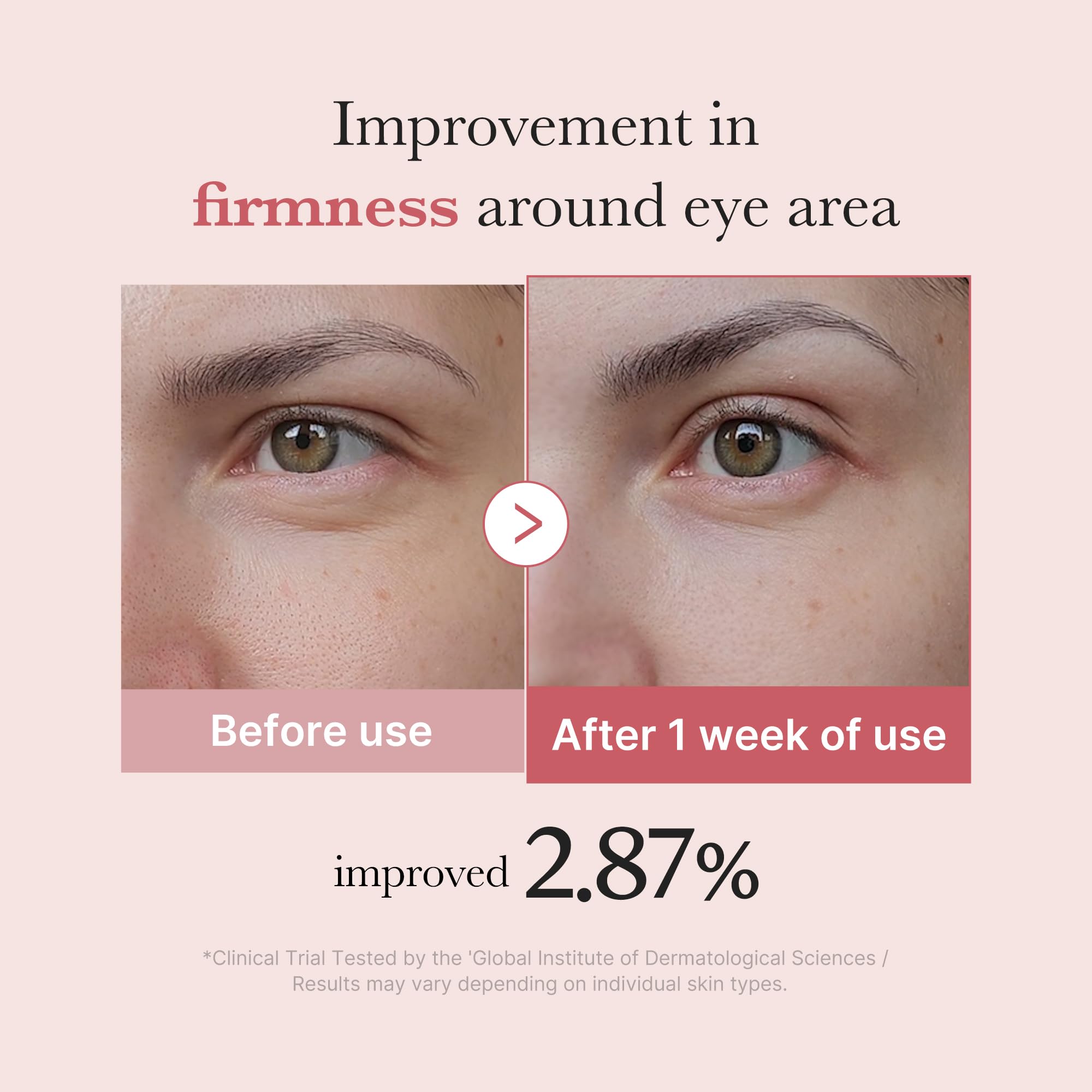 medicube Salmon DNA PDRN Pink Peptide Eye Serum with Niacinamide and 99% Purity Retinol for Fine Lines, Uneven Skin Tone, Korean Skin Care 1.01fl.oz 🍁 All In One Marketplace Canada