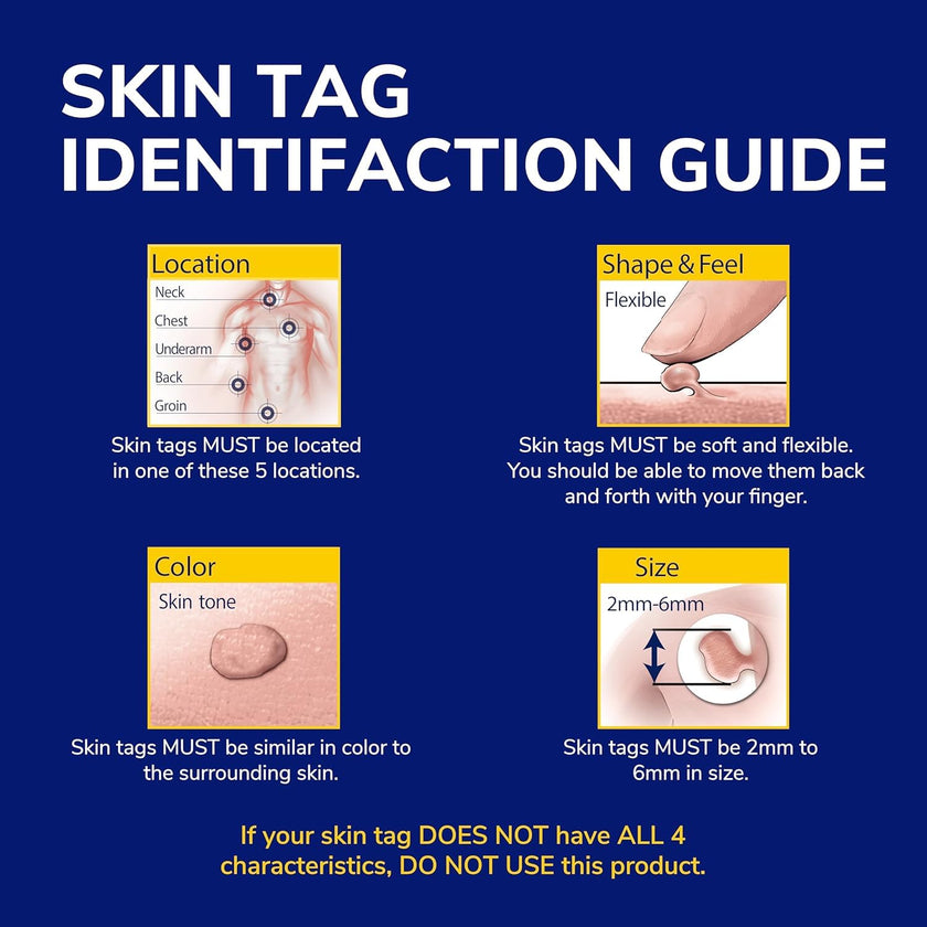 Dr. Scholl's Freeze Away Skin Tag Remover - At Home Skin tag Removal kit. Clinically Proven Skin Tag Removal in as Little as 1 Treatment. 1 Skin tag Removal kit, 12 Treatments 🍁 All In One Marketplace Canada