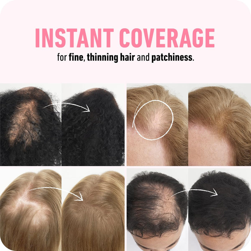 BOLDIFY Hair Fibers (28g) - Fill In Thinning and Fine Hair for an Instantly Fuller, Thicker Look - 14 Shades for Women & Men - Black 🍁 All In One Marketplace Canada