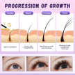 Lash Serum for Growth, Premium Eyelash Enhancer Care for Longer Thicker & Fuller, Gentle Formula Safe for Sensitive Eyes Non-Irritating Daily Use at Home & Travel - 5ml 🍁 All In One Marketplace Canada
