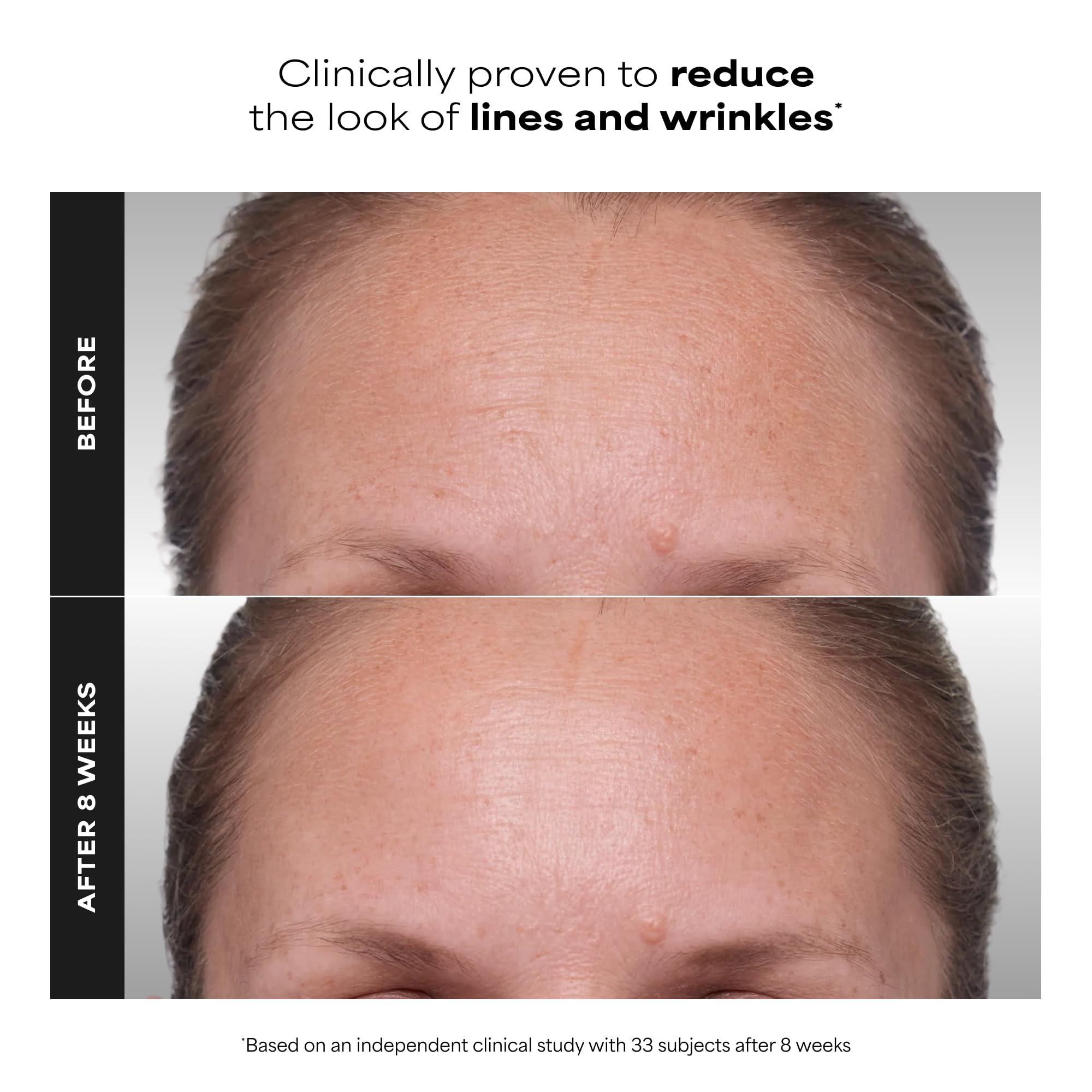 Paula's Choice CLINICAL 1% Retinol Treatment Cream with Peptides, Vitamin C & Licorice Extract, Anti-Aging Treatment for Wrinkles & Loss of Firmness, Fragrance-Free, 30 mL 🍁 All In One Marketplace Canada