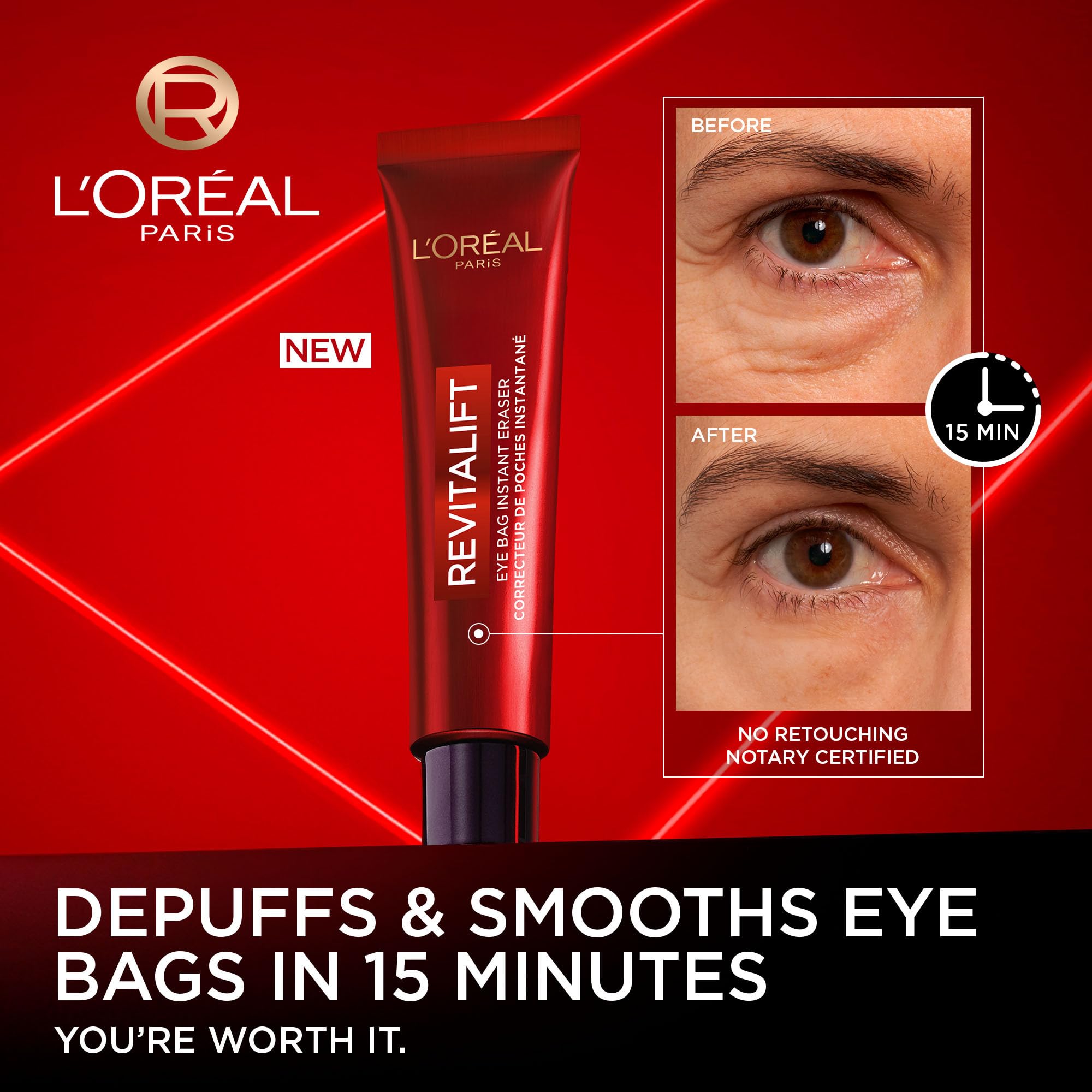 L'Oréal Paris Revitalift Triple Power LZR Instant Eraser Eye Cream, Under Eye Cream for Puffiness and Wrinkles, Anti Aging, Needle-Free Procedure Alternative, 15 mL 🍁 All In One Marketplace Canada