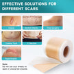 Pumkot Silicone Scar Sheets, Silicone Scar Tape(1.6” x 120” Roll-3M) 🍁 All In One Marketplace Canada
