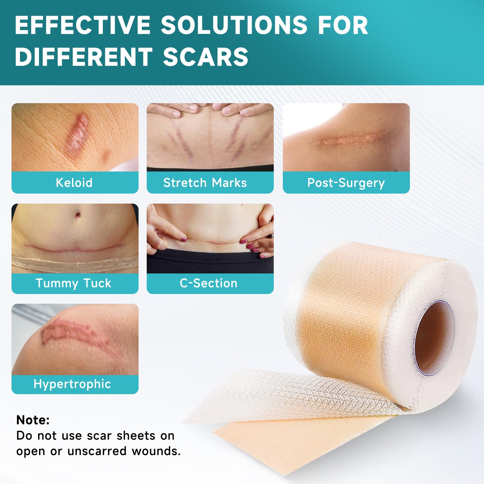 Pumkot Silicone Scar Sheets, Silicone Scar Tape(1.6” x 120” Roll-3M) 🍁 All In One Marketplace Canada