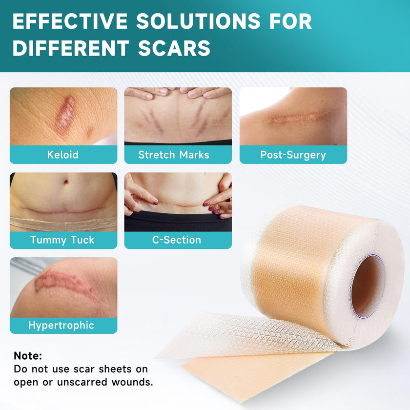 Pumkot Silicone Scar Sheets, Silicone Scar Tape(1.6” x 120” Roll-3M) 🍁 All In One Marketplace Canada