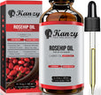 Kanzy Rosehip Oil for Face 120ml - Cold-Pressed Rosehip Oil for Skin, Hair, Nails & Body | Vegan & Cruelty-Free Moisturizing Oil for Daily Use 🍁 All In One Marketplace Canada