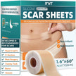 Silicone Scar Sheets, Silicone Scar Tape for Surgical Scars - 60