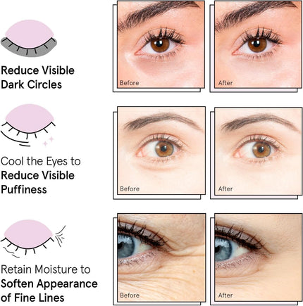 grace & stella Under Eye Mask - Birthday Gifts for Women, Gifts for Mom, Under Eye Patches to Reduce Dark Circles, Puffy Eyes, Eye Bags, Wrinkles, Travel Size Toiletries, Vegan (24 Pairs, Gold) 🍁 All In One Marketplace Canada