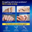 Arflom Toenail Fungus Treatment : 25% Undecylenic Fungal Nail Treatment Extra Strength - Toe and Fingernail with Tea Tree Oil (2pcs, 15ml each) 🍁 All In One Marketplace Canada