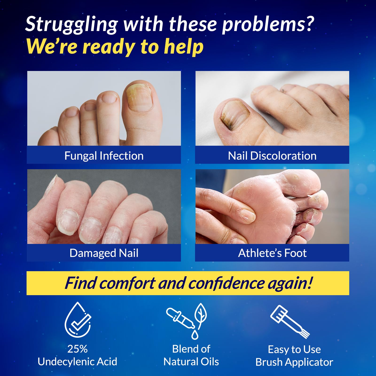 Arflom Toenail Fungus Treatment : 25% Undecylenic Fungal Nail Treatment Extra Strength - Toe and Fingernail with Tea Tree Oil (2pcs, 15ml each) 🍁 All In One Marketplace Canada