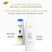 Dove Intensive Repair Shampoo & Conditioner for Damaged Hair, with Liquid Bio-Protein Care technology, 355ml (2 Shampoo + 2 Conditioner) 🍁 All In One Marketplace Canada