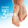 Flexitol Heel Magic for Treating Cracked and Dry Heels (70g) 🍁 All In One Marketplace Canada