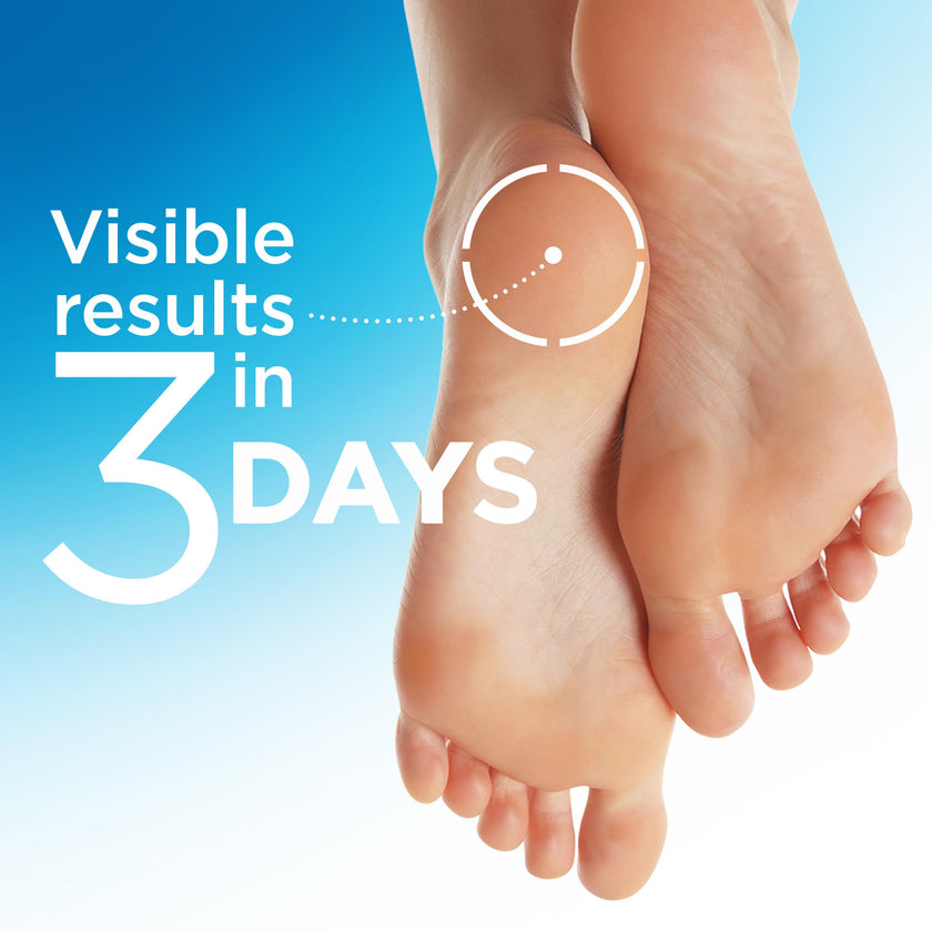 Flexitol Heel Magic for Treating Cracked and Dry Heels (70g) 🍁 All In One Marketplace Canada