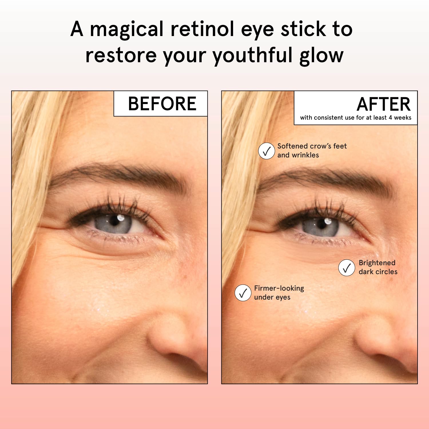 grace & stella Retinol & Caffeine Eye Cream Stick - Under Eye Cream for Dark Circles, Anti-Aging, Puffiness, Wrinkles, Undereye Bags - Brightener with Niacinamide - Vegan Skincare (0.13 oz/3.5 g) 🍁 All In One Marketplace Canada