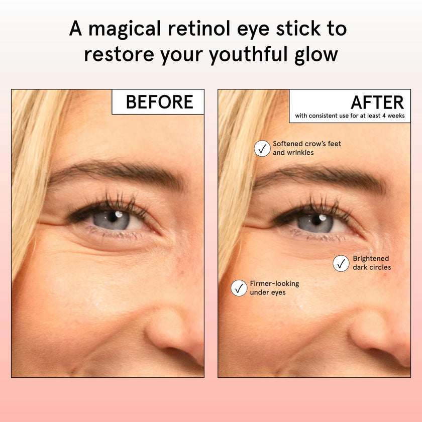 grace & stella Retinol & Caffeine Eye Cream Stick - Under Eye Cream for Dark Circles, Anti-Aging, Puffiness, Wrinkles, Undereye Bags - Brightener with Niacinamide - Vegan Skincare (0.13 oz/3.5 g) 🍁 All In One Marketplace Canada